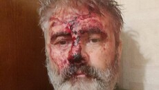 Unknown individuals beat "metropolitan" of OCU in Kyiv