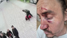 Бойовики жорстоко побили священника УПЦ в Чернівцях, його стан важкий