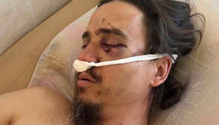Священник УПЦ отець Роман був побитий бойовиками біля собору в Чернівцях. Фото: Orthobuk