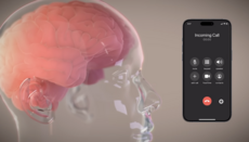Στη Neuralink του Ίλον Μασκ αποκάλυψαν σχέδια για τη συγχώνευση του εγκεφάλου με ΤΝ