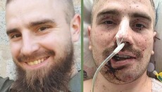 На Буковине просят молитв за тяжело раненого сына священника УПЦ