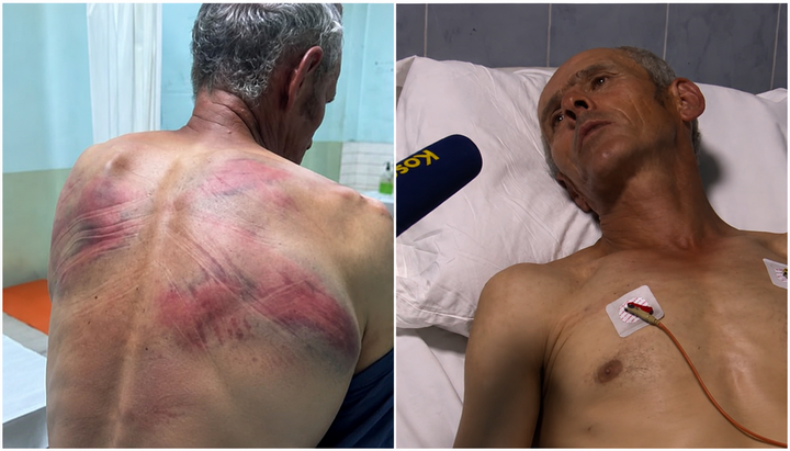 Nenad Rašković after allegedly being beaten by Kosovo police officers. Photo: Kosovo Online