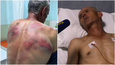 Serbian Church demands action over beating of parishioner in Kosovo